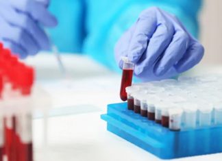 പിടിമുറുക്കി കോവിഡ്: സംസ്ഥാനത്ത് ഇന്നു മരണം ഏഴായി Covid 19 death_2020 Aug 16