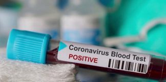 Covid 19_2020 Aug 15