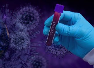 Covid 19 in US report_2020 Aug 09