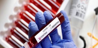 Malabarnews_covid positive