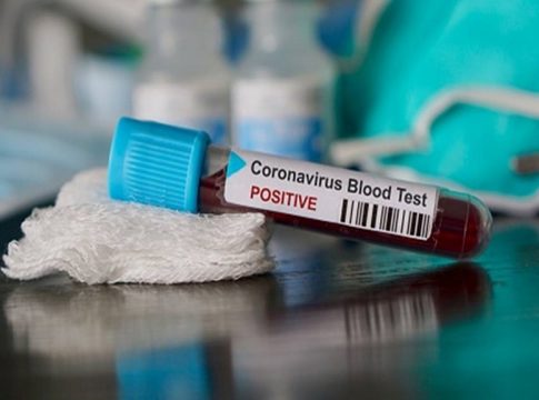 Malabarnews_covid in thrissur