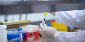 കോവിഡ് പരിശോധനയില് ക്രമക്കേട്; ആശുപത്രികള്ക്കും ലാബുകള്ക്കും എതിരെ നടപടി Malabarnews_malappuram news