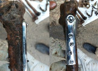 skull and bones found at Ponnani