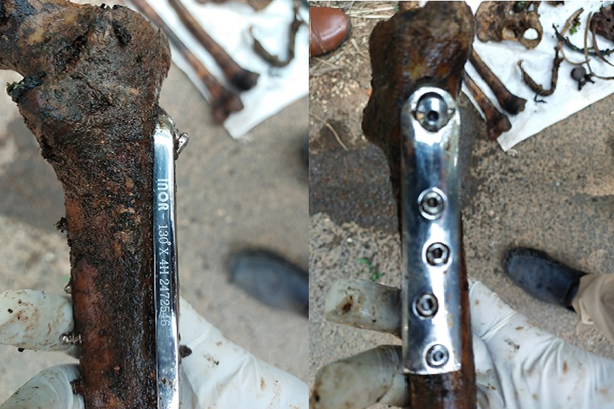 skull and bones found at Ponnani skull and bones found at Ponnani