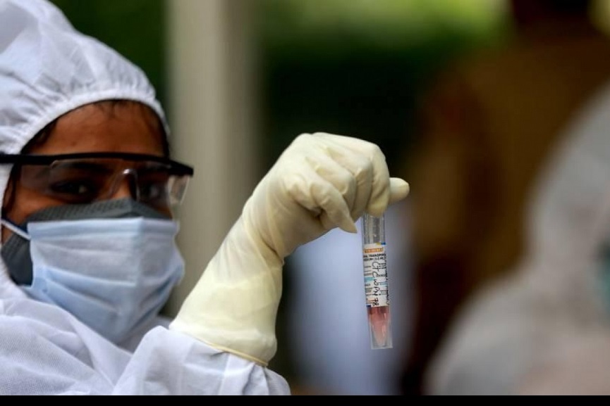 covid test2 covid test