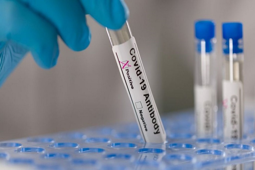 test positivity test positivity