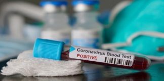 เดเตเดเตเดเดฌ เดเตเดทเตเดคเตเดฐเดคเตเดคเดฟเดฒเตโ เดฐเดนเดธเตเดฏเดฎเดพเดฏเดฟ เดชเตเด; เด
เดฑเตเดชเดคเตเดณเด เดชเตเดฐเตโเดเตเดเต เดเตเดตเดฟเดกเต; เดเตเดธเตเดเตเดคเตเดคเต covid positive