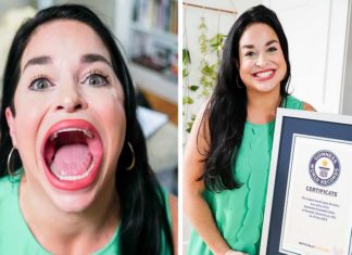 ലോകത്തിലെ ഏറ്റവും വലിയ വായ്; ഗിന്നസ് ബുക്കിൽ ഇടം നേടി 31കാരി largest-mouth-in-the world