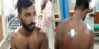 പാലക്കാട് ടാപ്പിങ് തൊഴിലാളിയെ കടുവ ആക്രമിച്ച സംഭവം; പ്രതിഷേധം കനക്കുന്നു