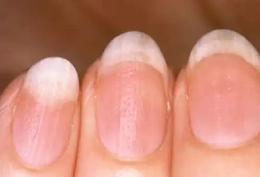 nail-health-11