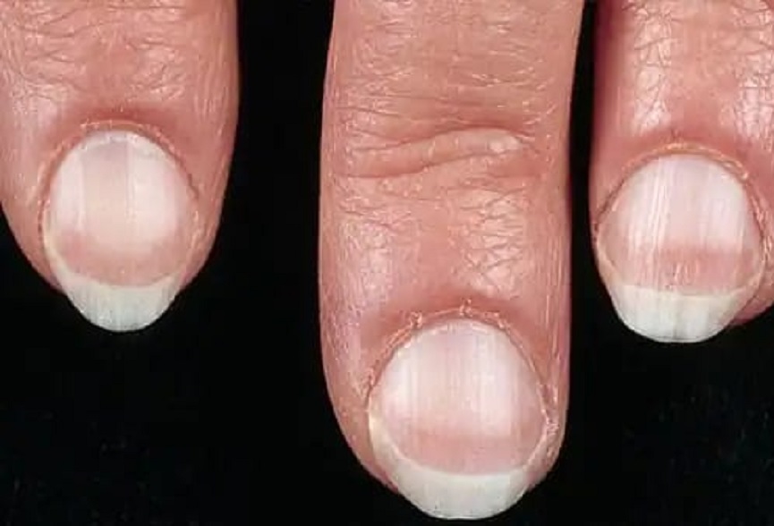 nail-health-6