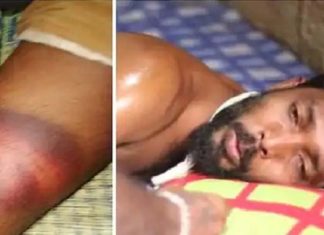 Poovar Issue