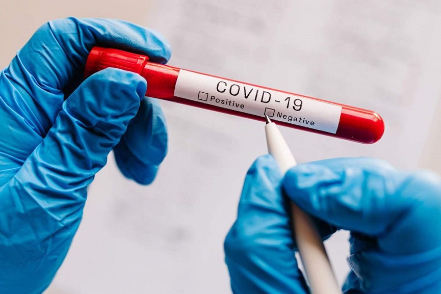 Covid-test covid test