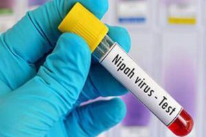 Nipah Virus
