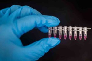 Nipah-Virus in Kozhikode