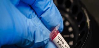 Nipah Virus