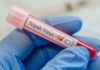 Nipah Virus