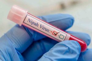 Nipah Virus