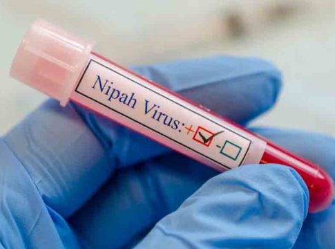 Nipah Virus