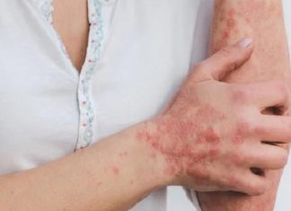 Health Issues Like Skin Problems and Hair Loss After Covid