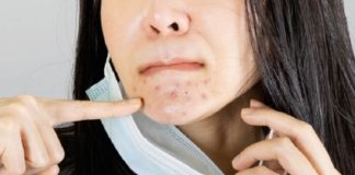 മാസ്കും മുഖക്കുരുവിന് കാരണമാകാം; ഇക്കാര്യങ്ങൾ ശ്രദ്ധിക്കാം mask-lifestyle