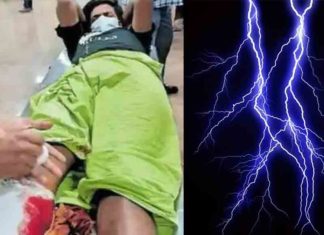 Lightning-hole-in-student's-leg