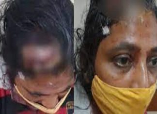 Assault on a young woman