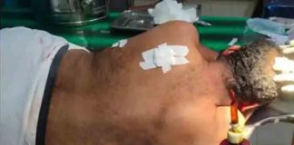 മകളെ ശല്യം ചെയ്തത് ചോദ്യം ചെയ്തു; പിതാവിനെ യുവാവ് കുത്തി പരിക്കേൽപ്പിച്ചു father of a girl attacked by young man