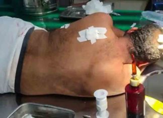 father of a girl attacked by young man