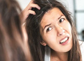 dandruff-solutions