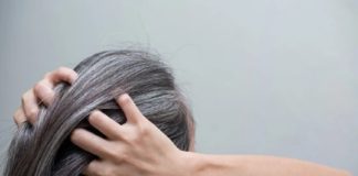 premature-greying of hair