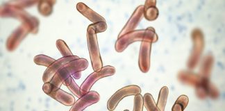 cholera