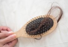 hair loss