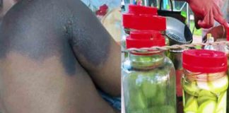 Student burn incident; Test results show that there is no acid in the store