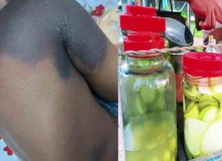 വിദ്യാർഥികൾക്ക് പൊള്ളലേറ്റ സംഭവം; ലായനിയിൽ ആസിഡ് ഇല്ലെന്ന് പരിശോധനാ ഫലം Student burn incident; Test results show that there is no acid in the store