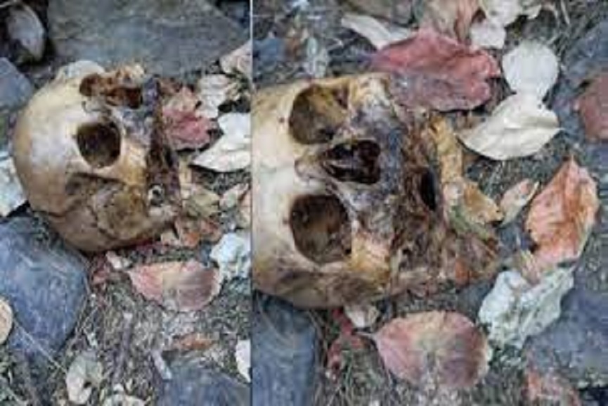 human skull found in vatakara skull found