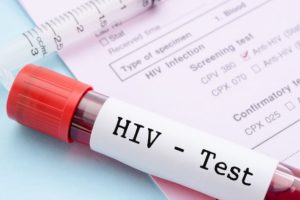 New strain of HIV discovered in Netherlands