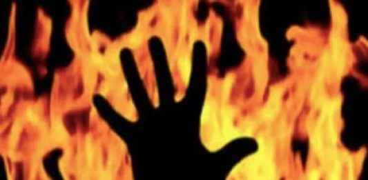burnt to death