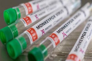 UAE Announce The Quarantine Norm Against The Monkey Pox
