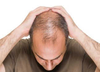 Calling man ‘bald’ is sexual harassment, decides court made up of bald people