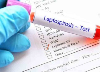 തിരുവനന്തപുരത്ത് എലിപ്പനി ബാധിച്ച് ഒരുമരണം leptospirosis death in Thiruvananthapuram