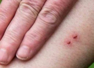 A fourth class student was bitten by a snake in Vadakkancherry
