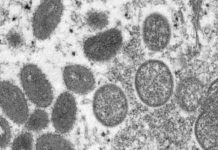 മങ്കിപോക്സ്; കേന്ദ്രസംഘം കേരളത്തിലേക്ക്, സ്ഥിതിഗതികൾ വിലയിരുത്തും monkeypox