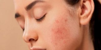 തണുപ്പ് കാലത്ത് ചർമാരോഗ്യം നിലനിർത്താം; ഇവ ഭക്ഷണത്തിൽ ഉൾപ്പെടുത്തൂ life style