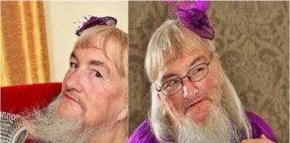 25 സെന്റിമീറ്റർ നീളമുള്ള താടിയും മീശയും; ഇത് സ്ത്രീയോ പുരുഷനോ? kauthuka varthakal