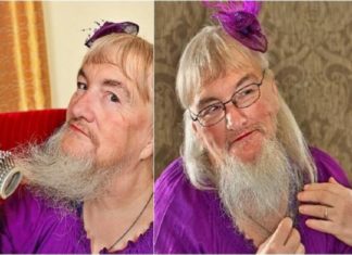 25 സെന്റിമീറ്റർ നീളമുള്ള താടിയും മീശയും; ഇത് സ്ത്രീയോ പുരുഷനോ? kauthuka varthakal