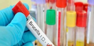 തിരുവനന്തപുരത്ത് ജന്തുജന്യ ബാക്ടീരിയ രോഗമായ ബ്രൂസല്ലോസിസ് സ്ഥിരീകരിച്ചു brucellosis disease