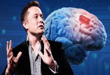 Elon Musks brain chip implants