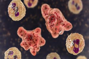 Amoeba disease