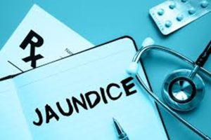 jaundice